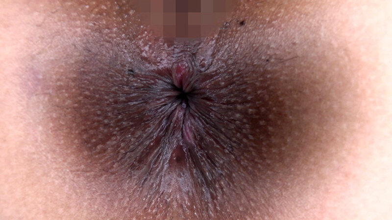 「肛門極限拡張 最上さゆき」のサンプル画像5